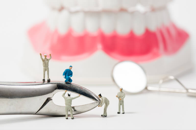 Een complete gids over botopbouw voor implantaten