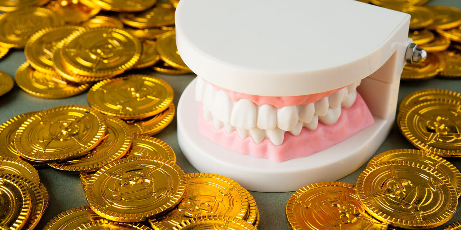 Wat kost een implantaat met een kroon? Blog Implantologiepraktijk