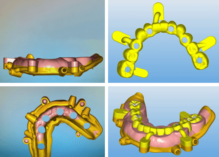 Ontwerp van mallen en een tijdelijke brug